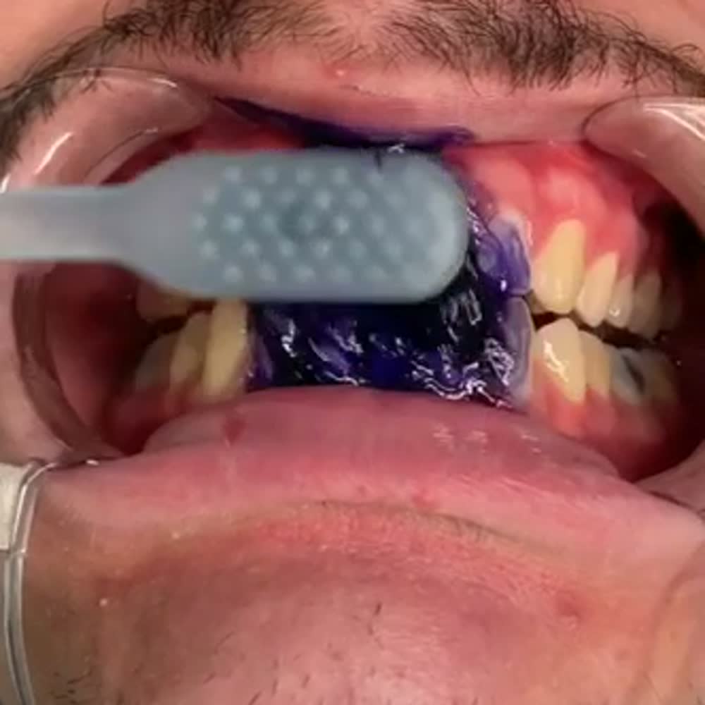 Purple V34 · Gel corrector de tono